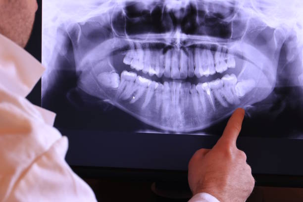 Best Emergency Care for Gum Disease in Cool Valley, MO